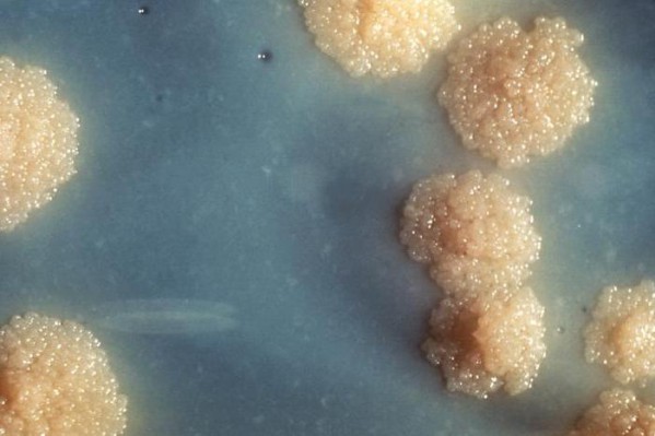 Анализ на микобактерии туберкулеза